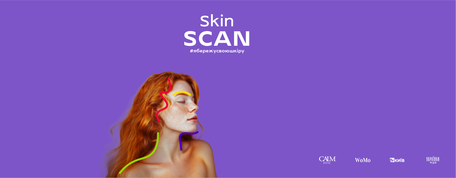 Diagnosis of birthmarks as part of the SkinScan project
